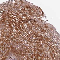 DEFB125 Antibody, Novus Biologicals 25 &mu;L; Unlabeled:Antibodies, Polyclonal